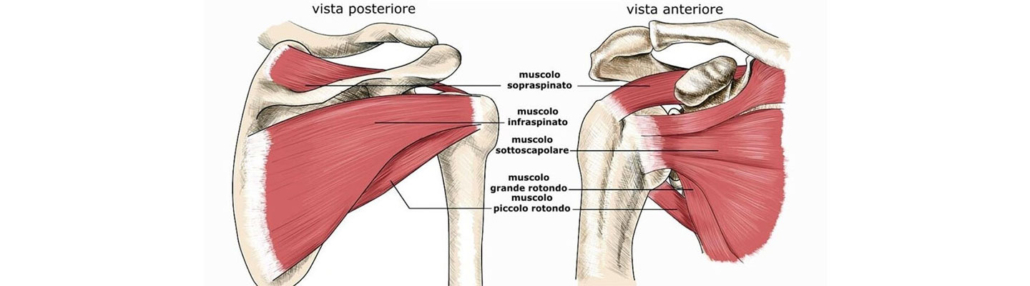 Tendinite della cuffia dei rotatori della spalla - cos'è e come si cura